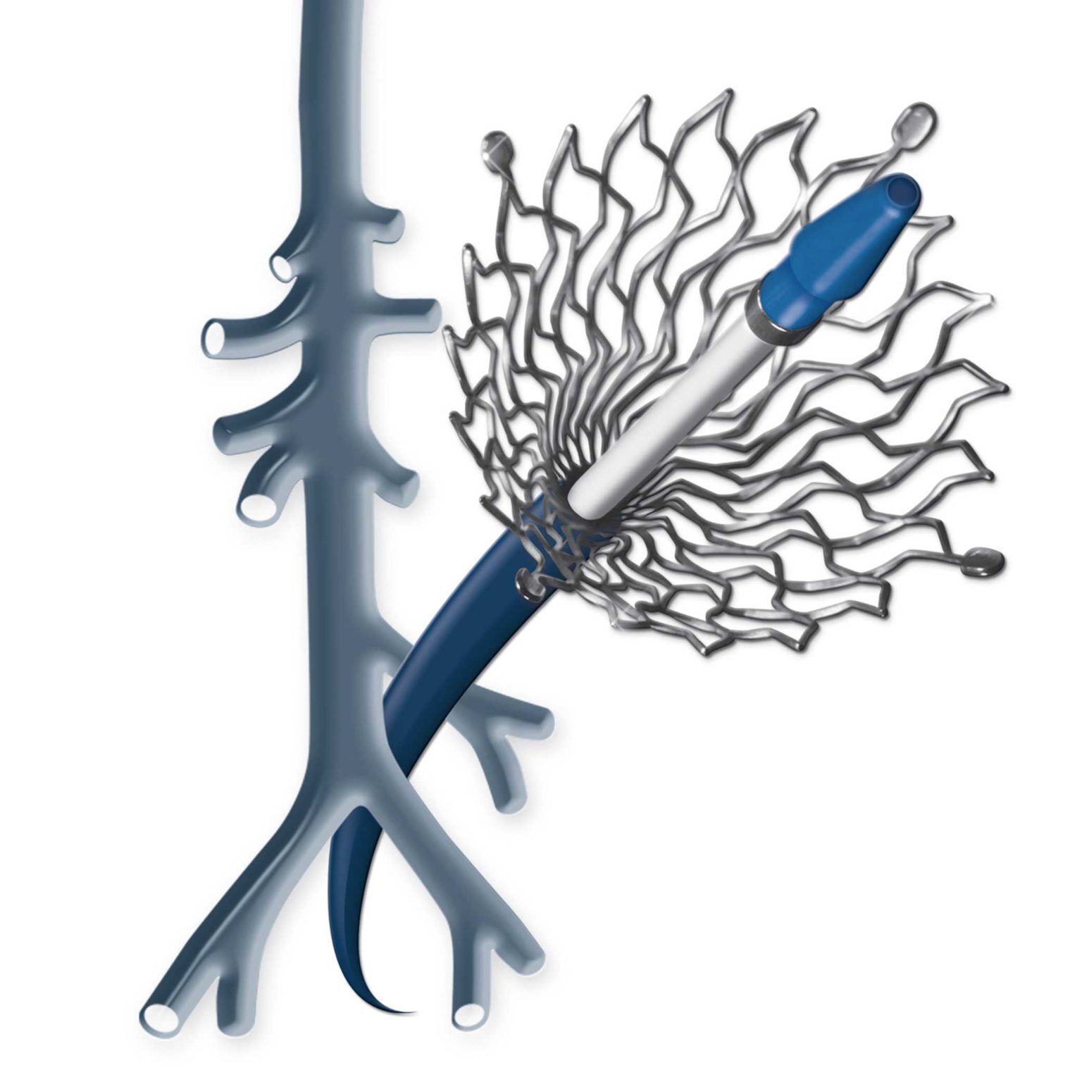 Sinus Xl Stent Healthcare21