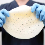 ARTIA™ Reconstructive Tissue Matrix - HC21